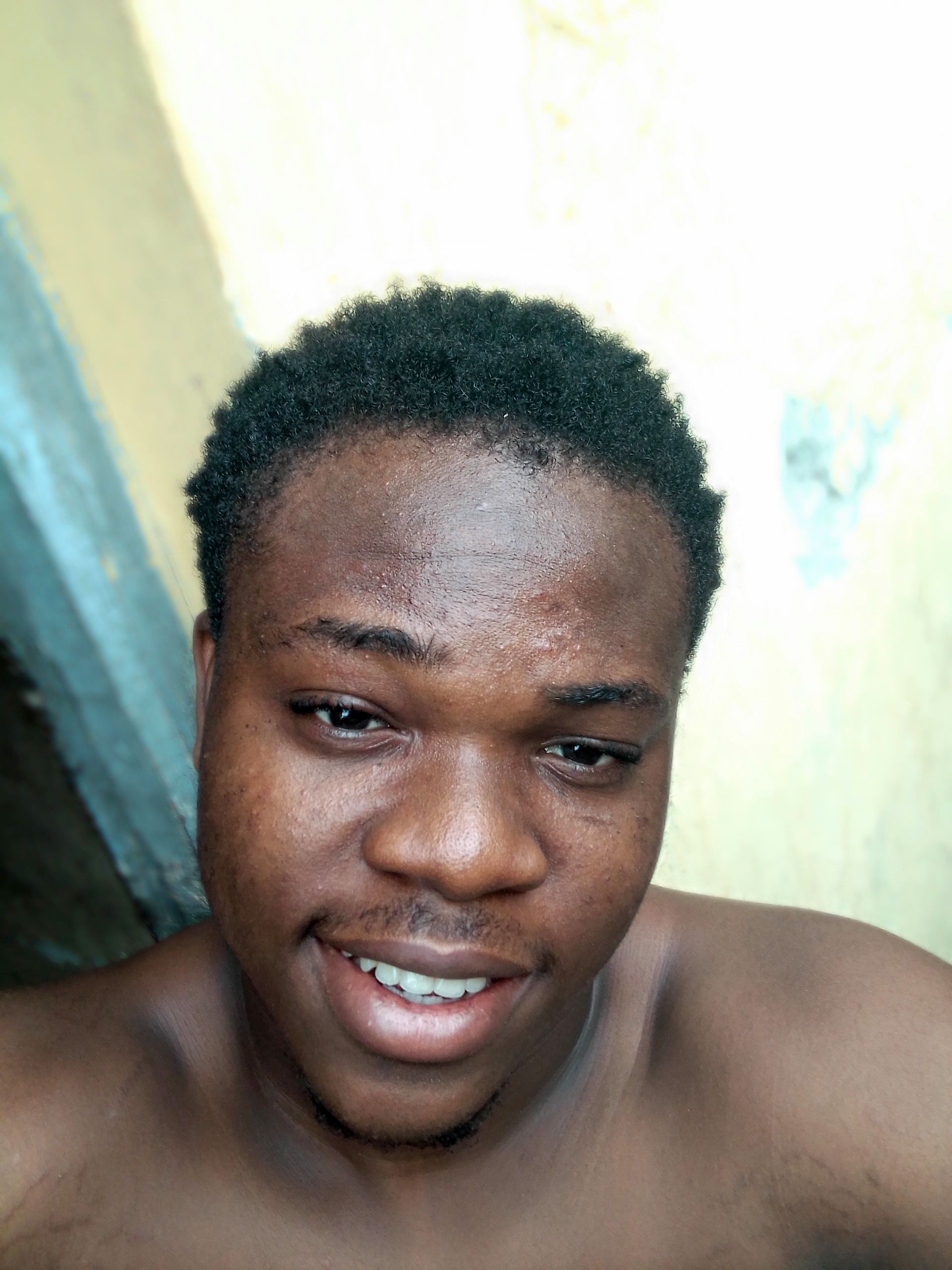 Decachy
